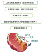 经常腹泻不可忽视，警惕肠道肿瘤作