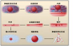 调控肿瘤细胞重编程，安罗替尼全新